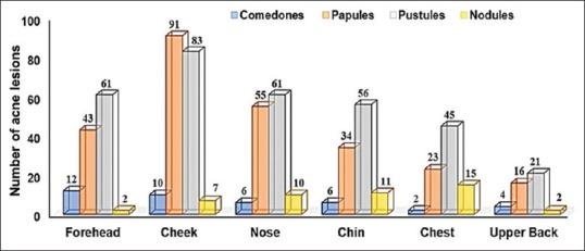 Exploring Trace Metal Imbalances: Serum Levels of Zinc, Selenium, Copper, Lead, Cadmium, and Mercury, and their Ratios in Acne Vulgaris Patients: An Analytical Cross-sectional Study.