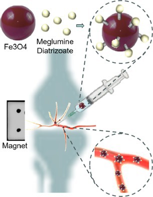 A New Nanotechnology for Imaging the Juxta-Articular Intraosseous Vasculature-Canal Complex and Related Clinical Pilot Studies.