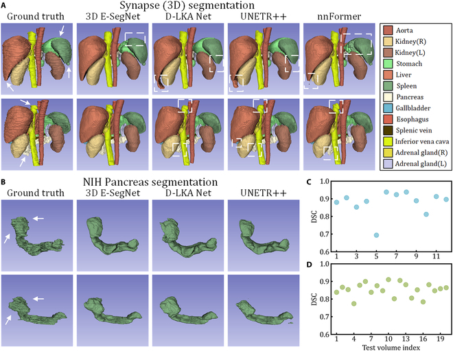 E-SegNet: E-Shaped Structure Networks for Accurate 2D and 3D Medical Image Segmentation.