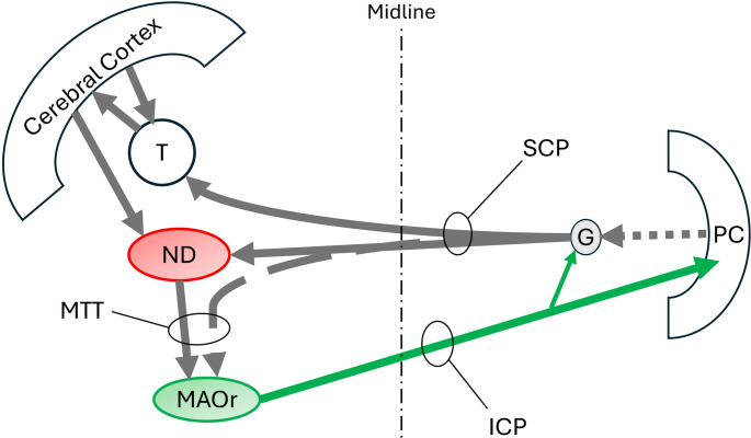 Multifaceted Mesodiencephalic Triangles: Insights into Hypertrophic Olivary Degeneration and Oculopalatal Tremor Pathophysiology.