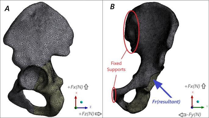 Is the innovative both column screw fixation technique a biomechanical game-changer in the fixation of acetabular posterior column fractures?