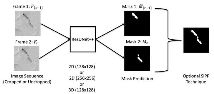 Gastrointestinal bleeding detection on digital subtraction angiography using convolutional neural networks with and without temporal information.