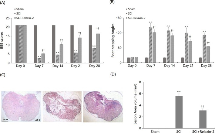 Relaxin-2 Ameliorates Spinal Cord Injury by Inhibiting Microglia Activation.