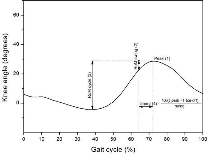 Identification of stiff-knee gait in stroke survivors.