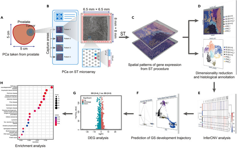 Applications and prospects of spatial transcriptomics in prostate cancer research: A narrative review.