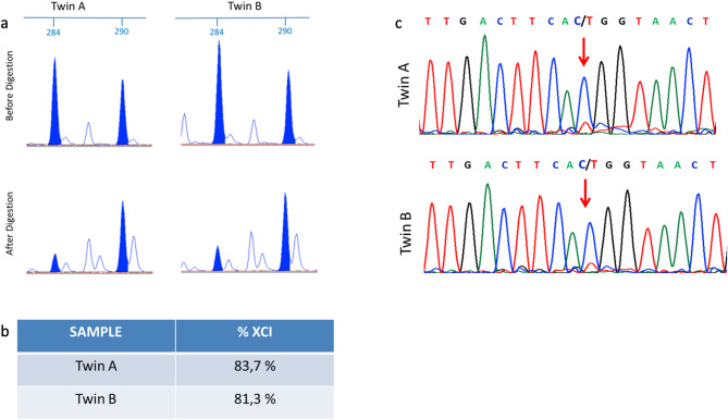 Clinical differences in monozygotic twins with Rett syndrome: case report and systematic review.