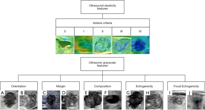 Enhancing diagnostic precision for thyroid C-TIRADS category 4 nodules: a hybrid deep learning and machine learning model integrating grayscale and elastographic ultrasound features.