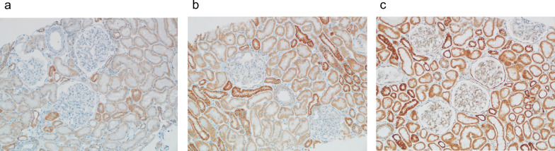Imaging renal mitochondrial dysfunction in chronic kidney disease: a repurposed role for [<sup>99m</sup>Tc]Tc-MIBI SPECT/CT.