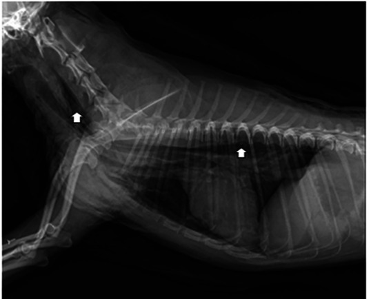 Tracheal Reconstruction Using a Nitinol Stent for Thoracic Tracheal Rupture.