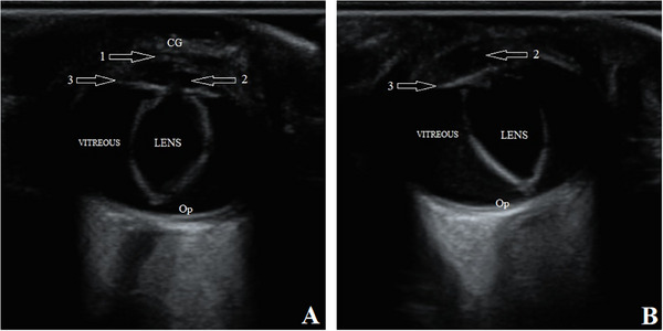 Complex Microphthalmia in Three Central Asian Shepherd Dogs.