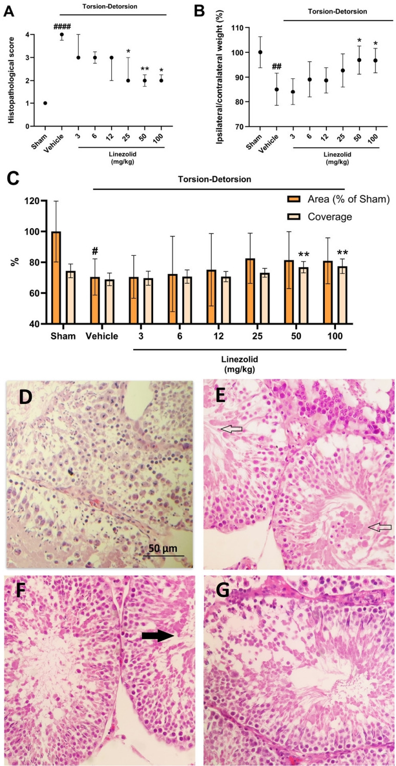 Linezolid mitigates tissue injury in experimental model of pediatric testicular torsion: TLR-4/MAPK/NF-κB involvement.