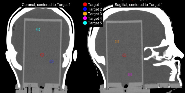 Multicenter multiplatform pattern-of-practice analysis of single-isocenter multitarget stereotactic radiosurgery.