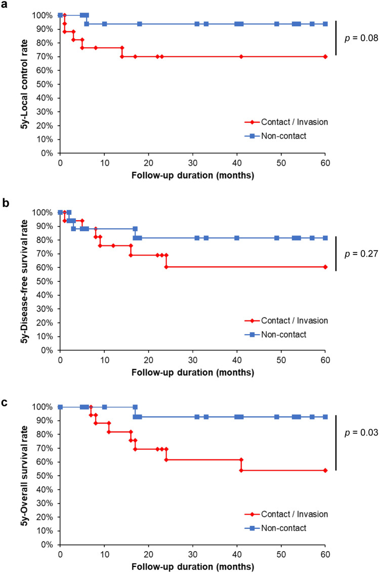 Pterygomandibular raphe invasion as a novel grading and prognostic factor for squamous cell carcinoma of buccal mucosa: a retrospective study with propensity score matching.