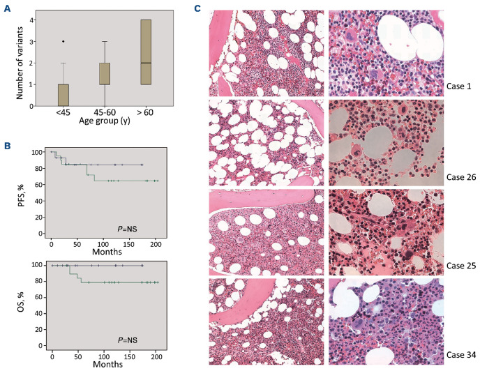 Clonal hematopoiesis is common in bone marrow of patients with classical Hodgkin lymphoma.