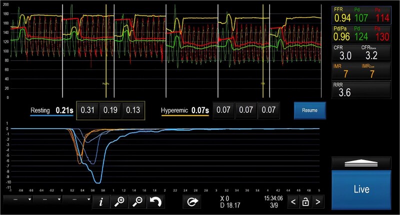 When chest pain is not what it seems: time for right diagnosis and right treatment-a case report.