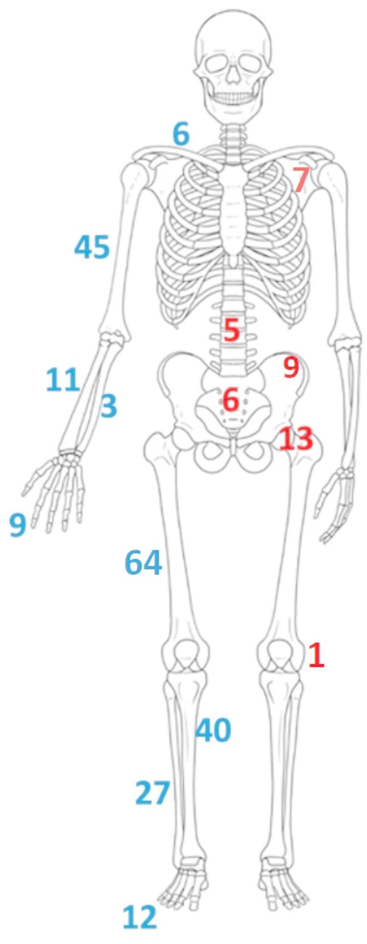 Aneurysmal bone cysts (ABC): Retrospective analysis of two hundred and fifty eight cases.