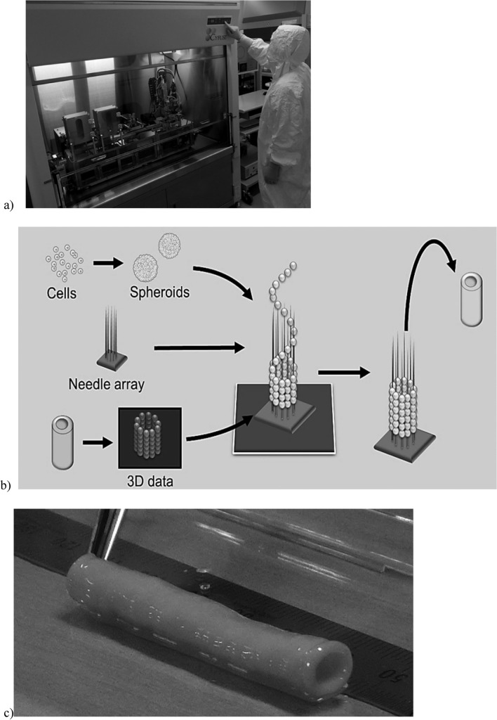 Artificial blood vessels-clinical development of TEVG.