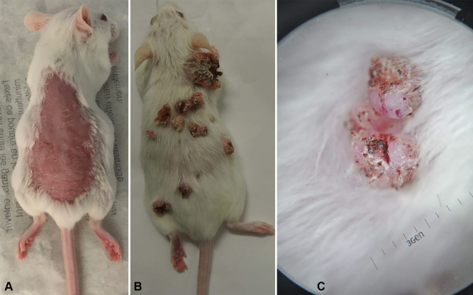 Stratifying Skin Cancer Patients and Guiding Treatment Decisions Through Combined p53 and p63 Expression Analysis.