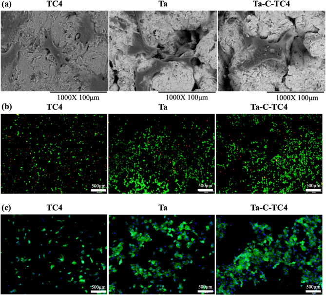 Magnetron sputtering to enhance bone integration of tantalum-coated titanium implants: an in vitro and in vivo analysis.