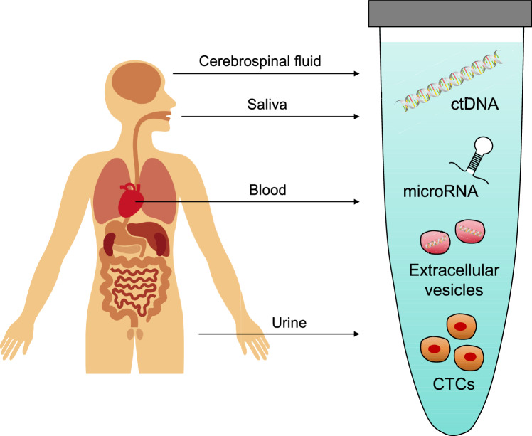 Advances in liquid biopsy for bone and soft-tissue sarcomas.