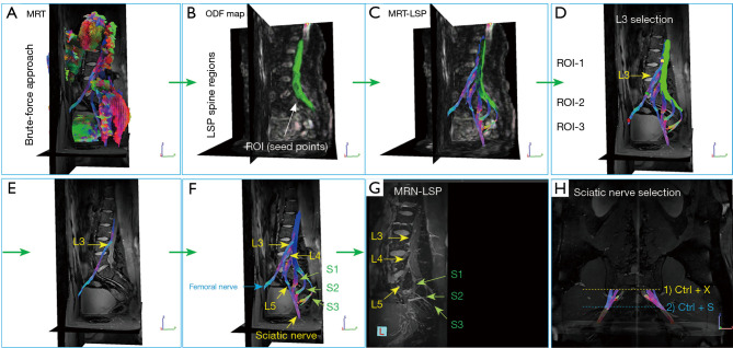 Exploring non-invasive diagnostic tools for deep gluteal syndrome: a multimodal approach integrating clinical and imaging techniques.
