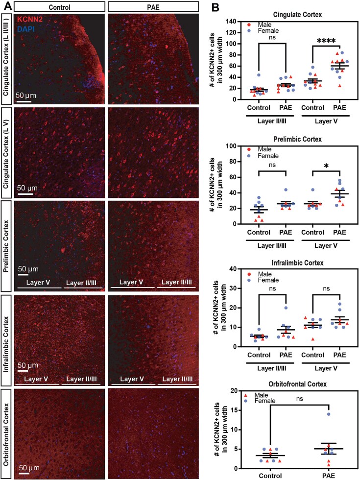 Intranasal Administration of KCNN2 Blocking Peptide Improves Deficits in Cognitive Flexibility in Mouse Model of Fetal Alcohol Spectrum Disorders.