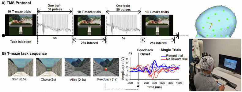 Blunted anterior midcingulate response to reward in opioid users is normalized by prefrontal transcranial magnetic stimulation.