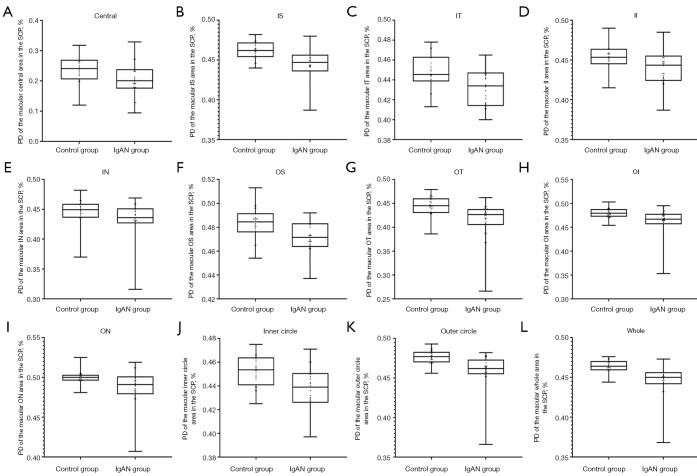 Quantitative analysis of macular and optic disc microvascular parameters in patients with immunoglobulin A nephropathy using optical coherence tomography angiography.