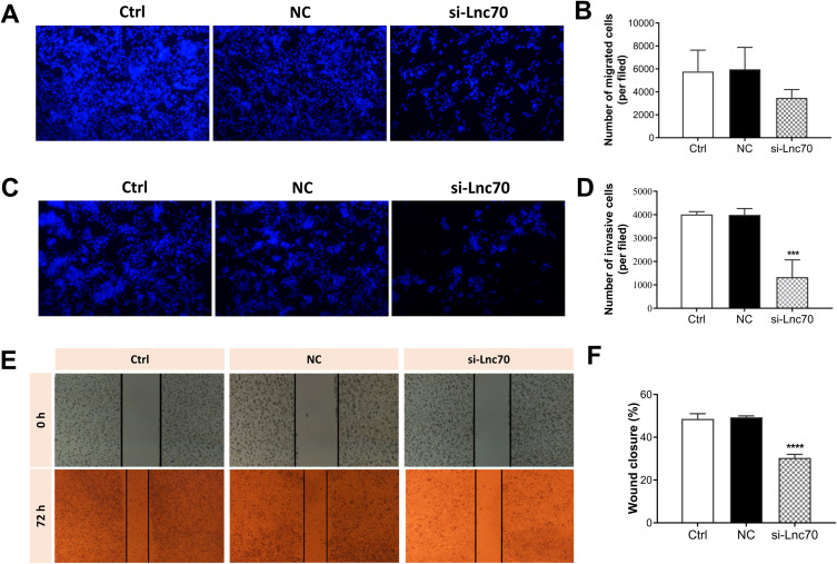 Mi-Lnc70 Regulates the Progression of Murine Pancreatic β-Cell Line and Affects the Synthesis of Insulin and Glucagon.