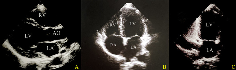 Enhancing predictions of subclinical cardiac dysfunction in SLE patients through integrative machine learning analysis.