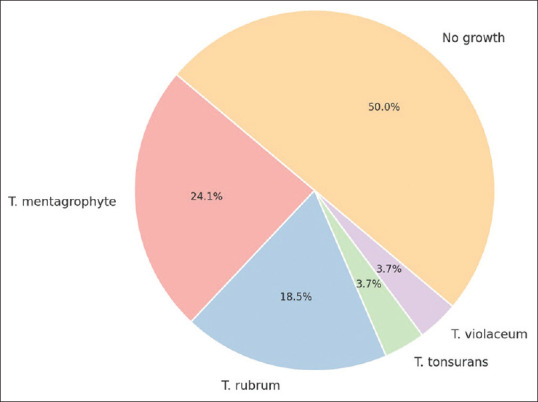 Trichophyton Mentagrophytes : An Emerging Cause of Tinea Capitis in Rural Part of North Karnataka.
