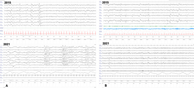 Clinical differences in monozygotic twins with Rett syndrome: case report and systematic review.