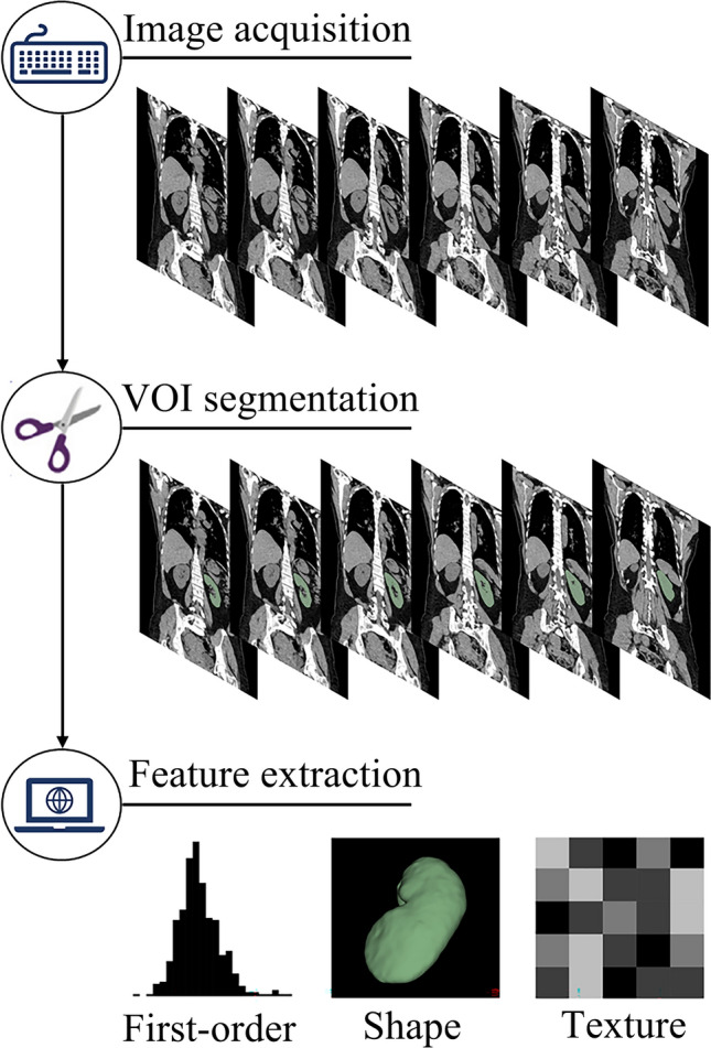 Developing a CT radiomics-based model for assessing split renal function using machine learning.