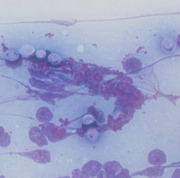 Rare Case of Systemic Cryptococcal Lymphadenopathy in a Persian Cat.