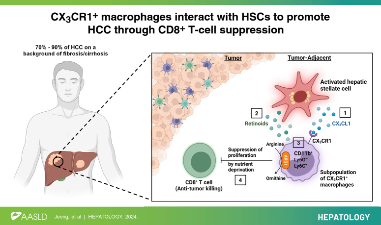 CX3CR1+ macrophages interact with HSCs to promote HCC through CD8+ T-cell suppression.