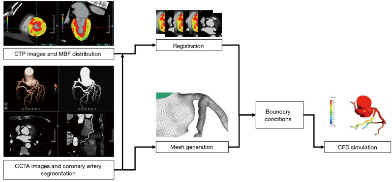 Fractional flow reserve calculation optimized by myocardial computed tomography perfusion information.