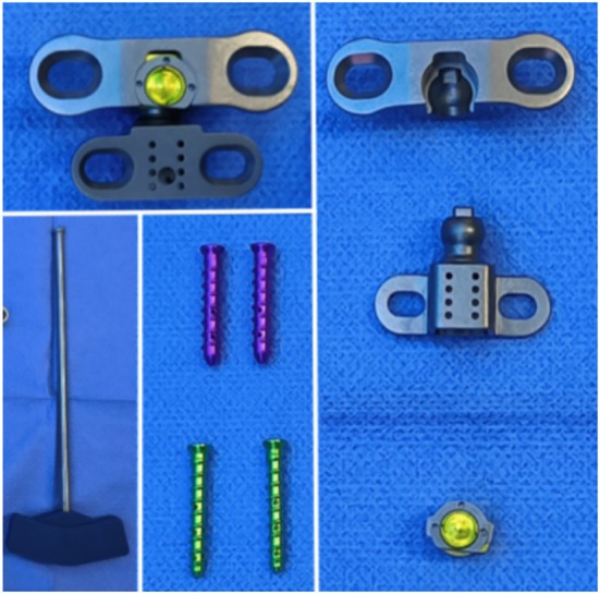 Design of a Novel Artificial Atlanto-Odontoid Joint and Its Anatomical and Radiological Studies Following Transoral Pharyngeal Approach Arthroplasty.