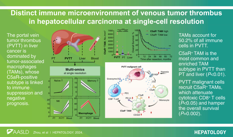 Distinct immune microenvironment of venous tumor thrombus in hepatocellular carcinoma at single-cell resolution.