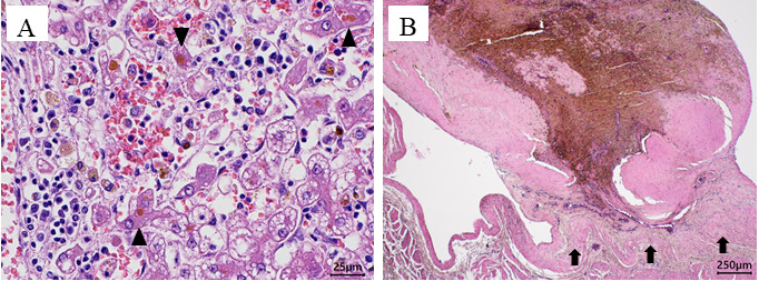 Treatment of portal vein thrombosis with rivaroxaban in an American cocker spaniel with chronic hepatitis: a case report.