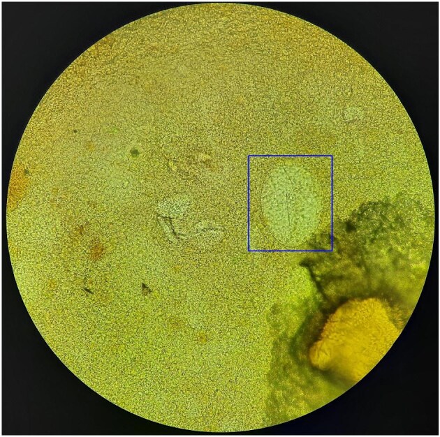Variability of interobserver interpretation of selected helminth ova in the development of a training image set.