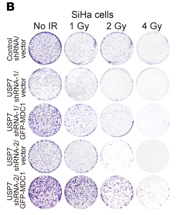 Corrigendum to Ubiquitin-specific protease 7 sustains DNA damage response and promotes cervical carcinogenesis.