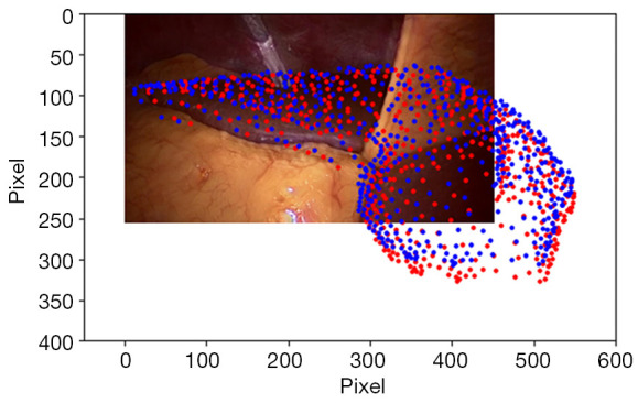 Non-rigid image-volume registration for human livers in laparoscopic surgery.