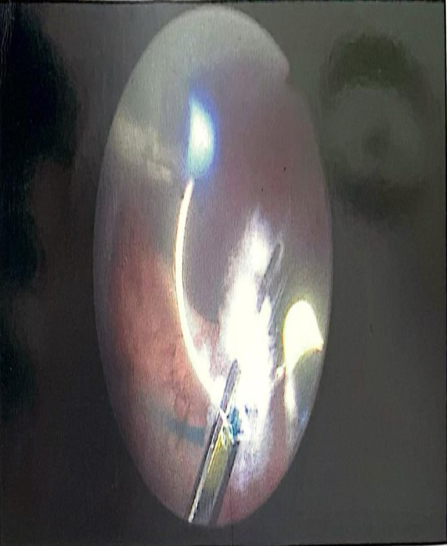 Abstract Image