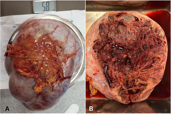 What is your diagnosis?