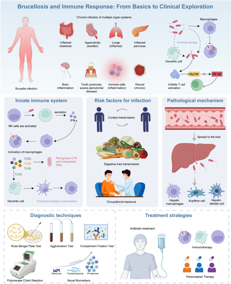 Progress in brucellosis immune regulation inflammatory mechanisms and diagnostic advances.