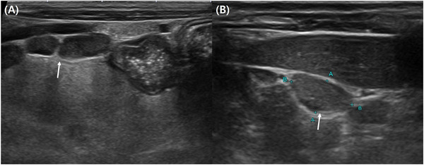 Rare Case of Systemic Cryptococcal Lymphadenopathy in a Persian Cat.