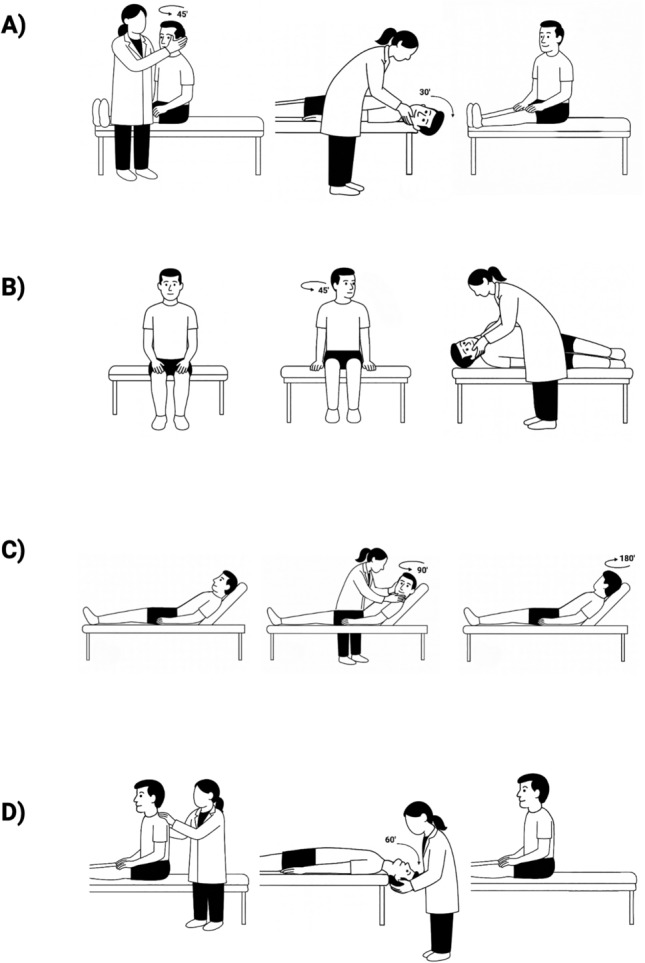 Rethinking positional nystagmus: beyond BPPV.