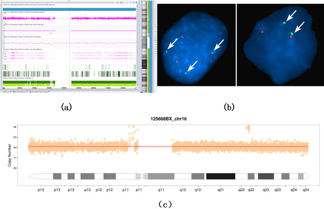 Prenatal diagnosis and pregnancy outcomes of mosaicism detected by CMA-seq.