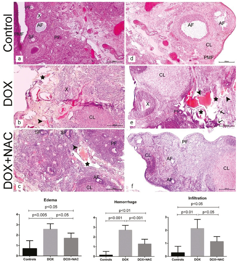 Protective effect of N-acetylcysteine in doxorubicin-induced primary ovarian failure in female rats.
