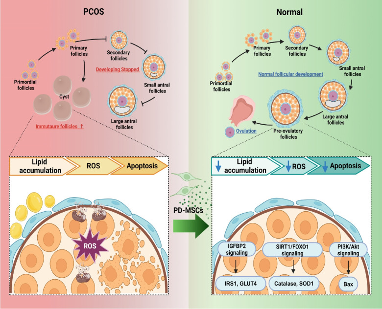 Recent trends in polycystic ovary syndrome treatment based on adult stem cell therapies.